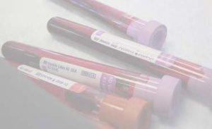 Blood Test Results Toxicologist reports aid in focusing investigations to probable sources.